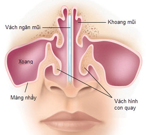 Ảnh 1 của Viêm mũi vận mạch